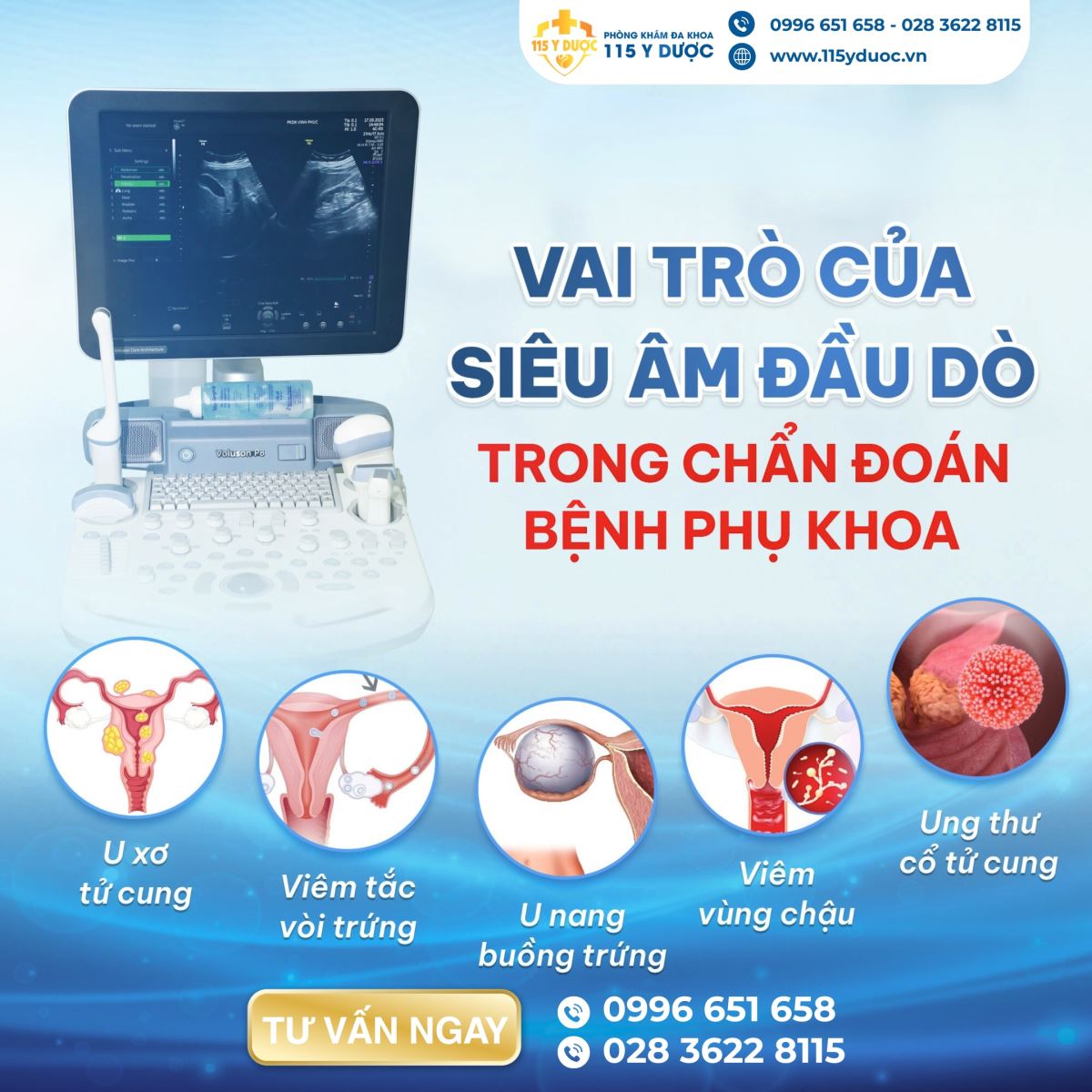 SIÊU ÂM ĐẦU DÒ ÂM ĐẠO CÔNG CỤ CHẨN ĐOÁN CHÍNH XÁC TRONG PHỤ KHOA